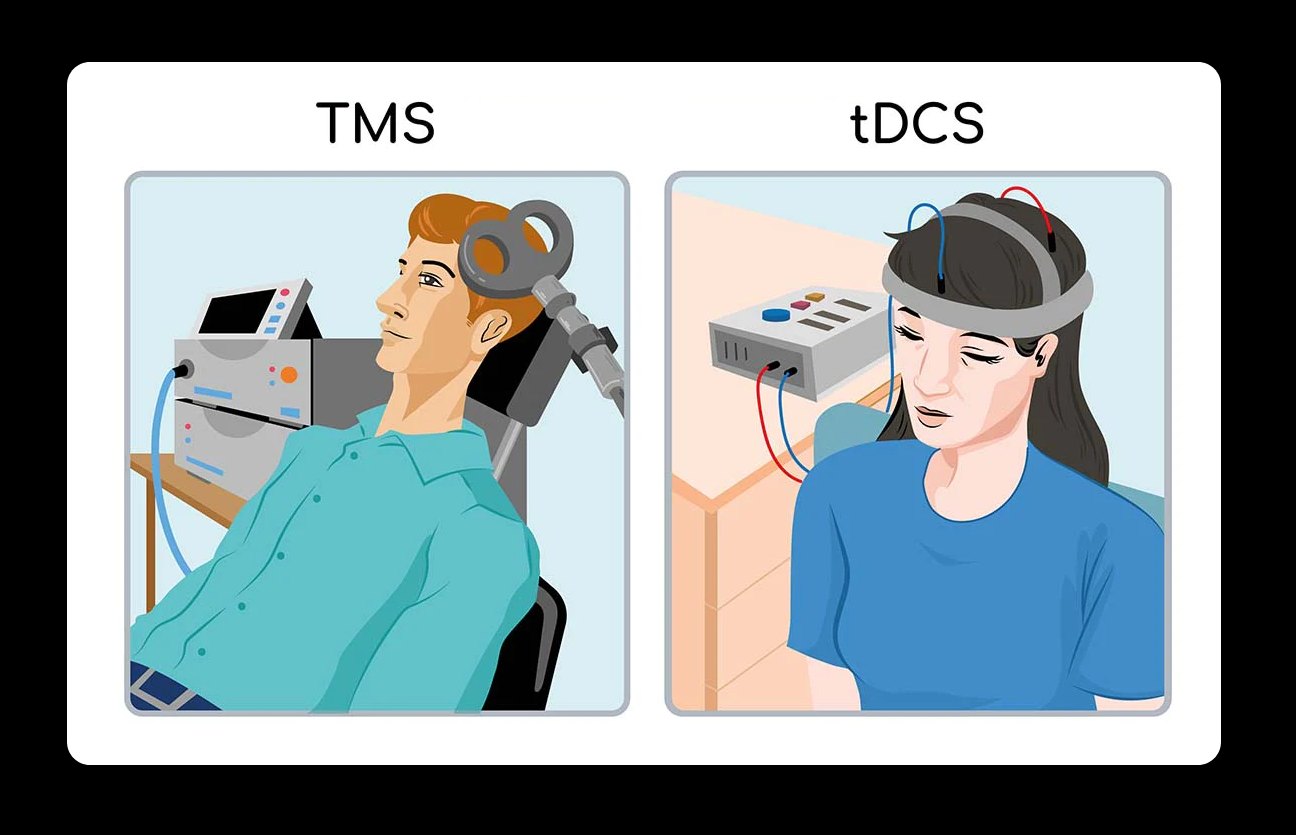 TMS and tDCS